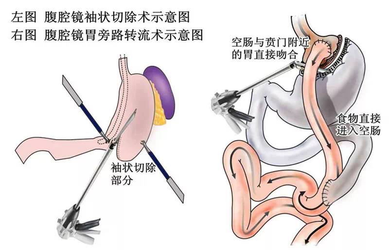 耳夹运用了什么原理